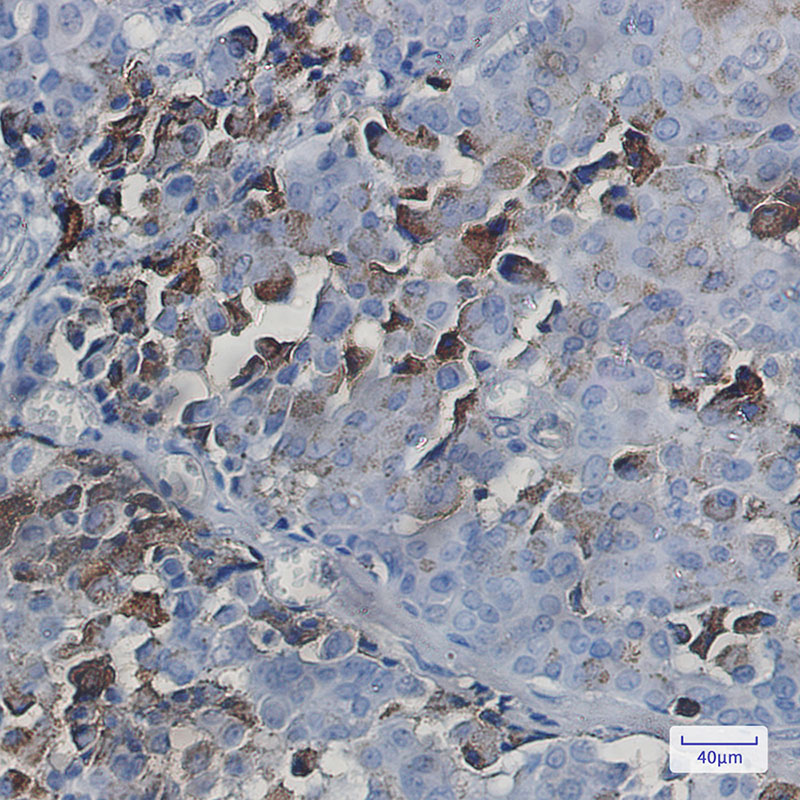 4 - NXF1 Rabbit mAb AP75837