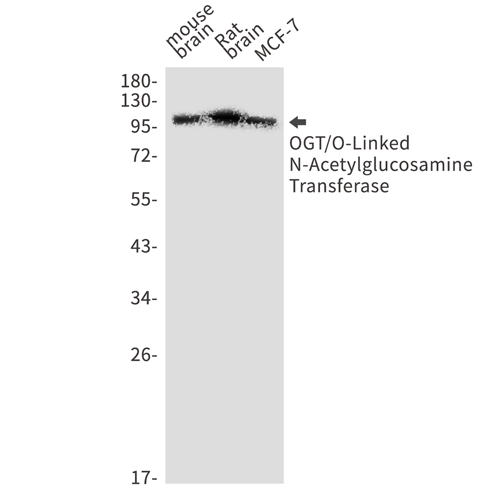 1 - OGT Rabbit mAb AP75839