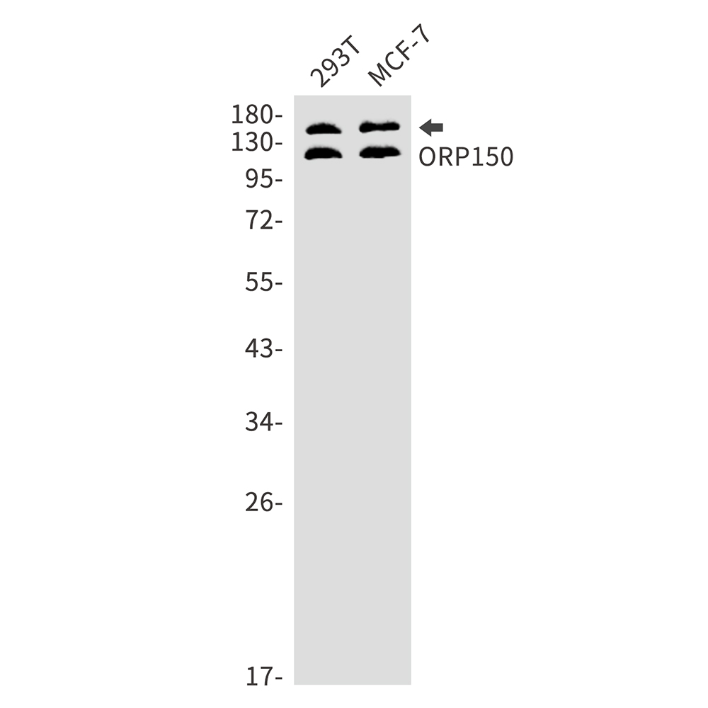 1 - ORP150 Rabbit mAb AP75842