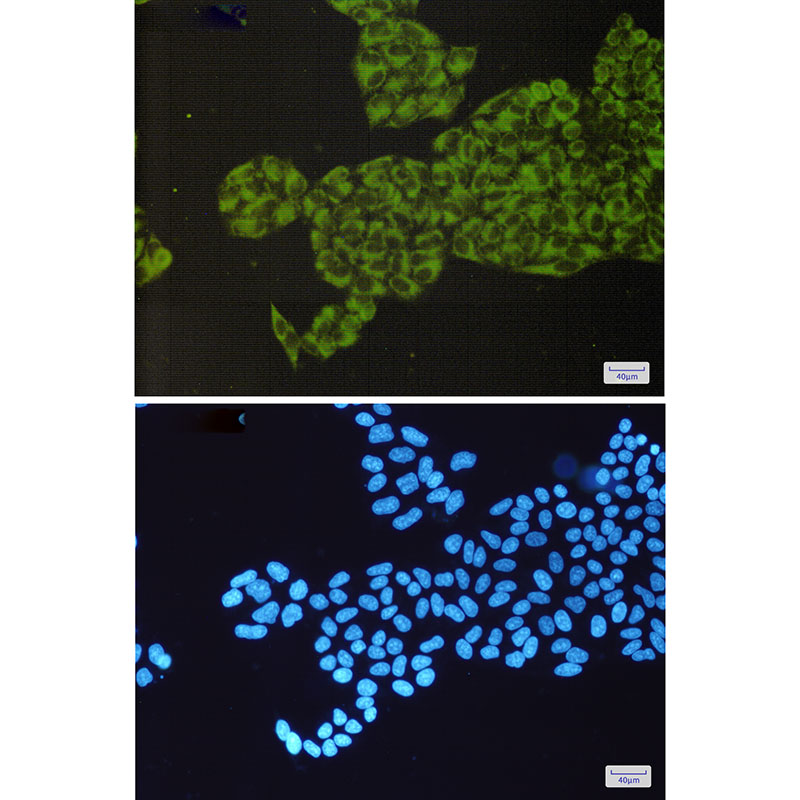 8 - ORP150 Rabbit mAb AP75843