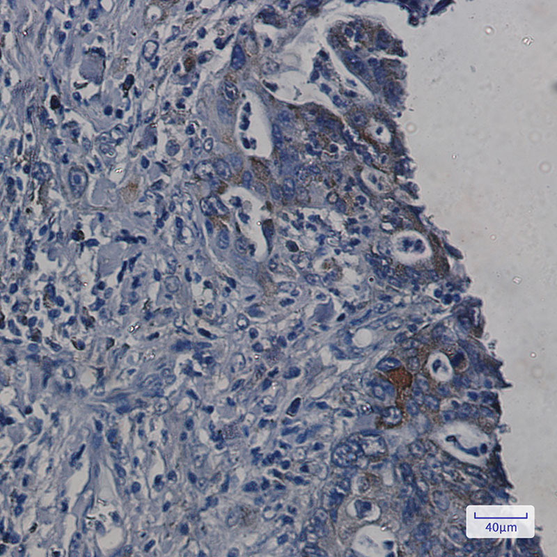 4 - ORP150 Rabbit mAb AP75843
