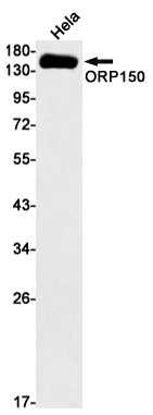 1 - ORP150 Rabbit mAb AP75843