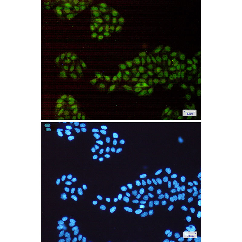 8 - [KD]p150 CAF1 Rabbit mAb AP75846
