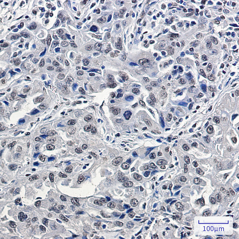 4 - [KD]p150 CAF1 Rabbit mAb AP75846