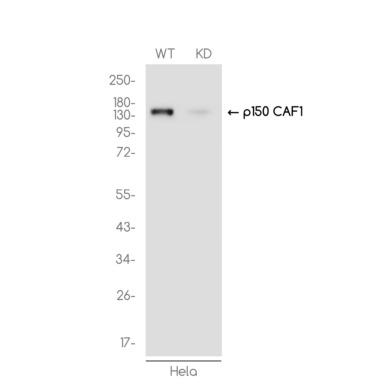 1 - [KD]p150 CAF1 Rabbit mAb AP75846