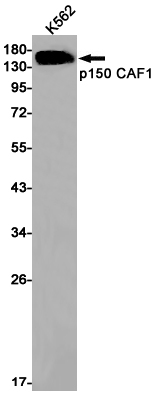 2 - [KD]p150 CAF1 Rabbit mAb AP75846
