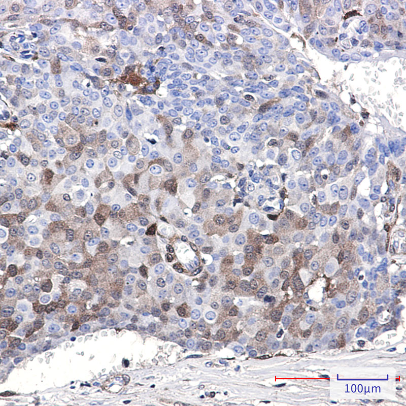 8 - p18 INK4c/CDKN2C Rabbit mAb AP75847