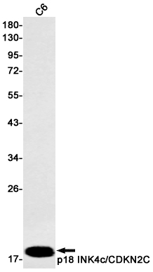 2 - p18 INK4c/CDKN2C Rabbit mAb AP75847
