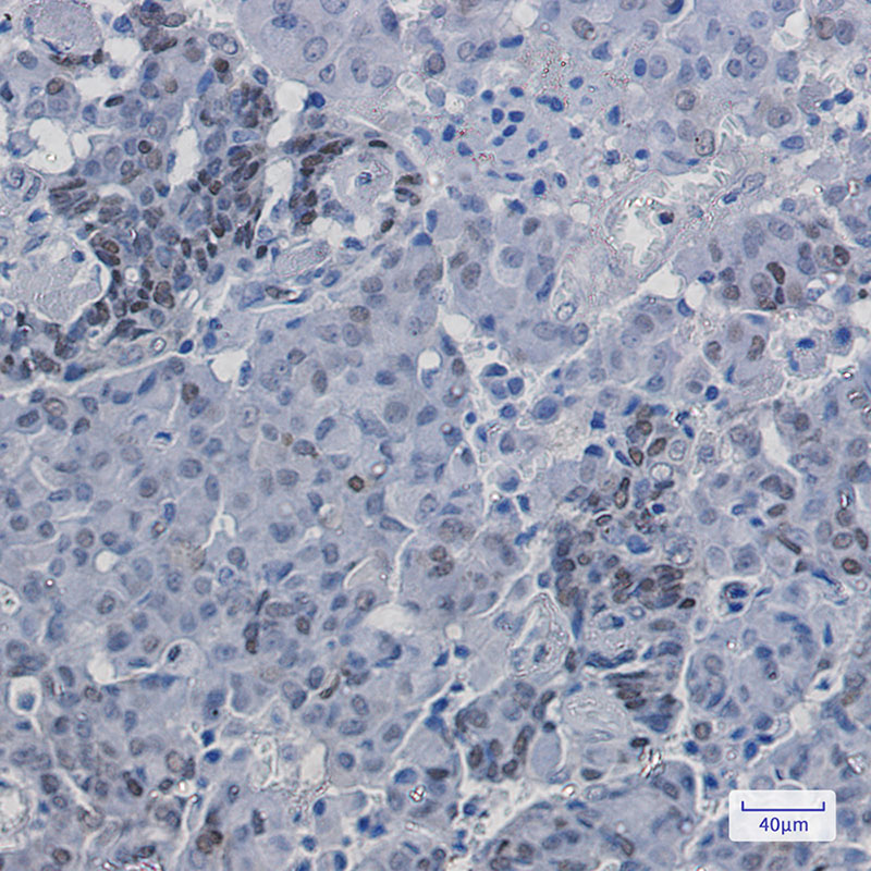 5 - Phospho-p27 KIP 1 (Ser10) Rabbit mAb AP75849