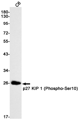 2 - Phospho-p27 KIP 1 (Ser10) Rabbit mAb AP75849