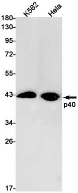 1 - p40 Rabbit mAb AP75852