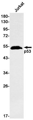 1 - p53 Rabbit mAb AP75855