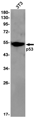 1 - p53 Rabbit mAb AP75856