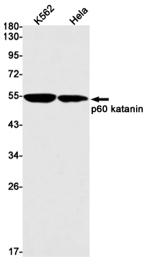 1 - p60 Katanin Rabbit mAb AP75857