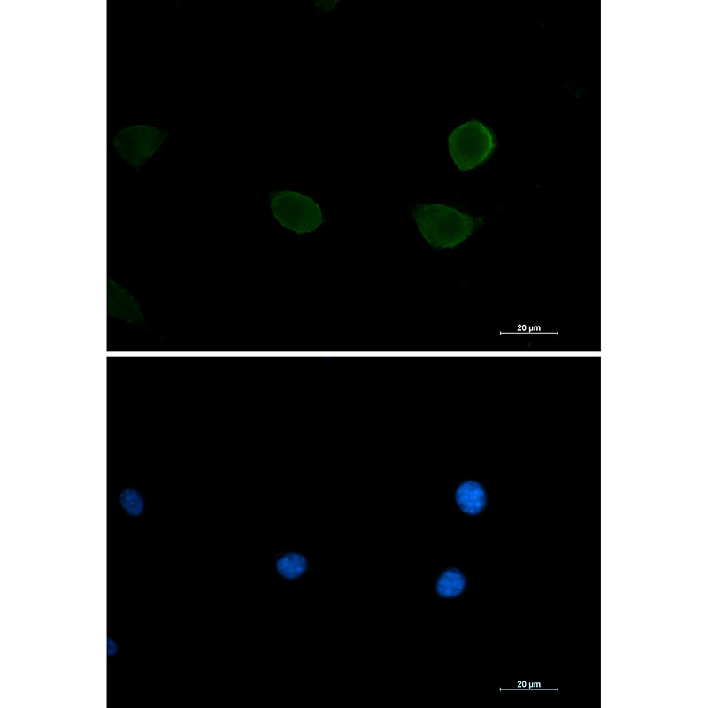 2 - [KO]P70 S6 Kinase beta/SRK Rabbit mAb AP75858