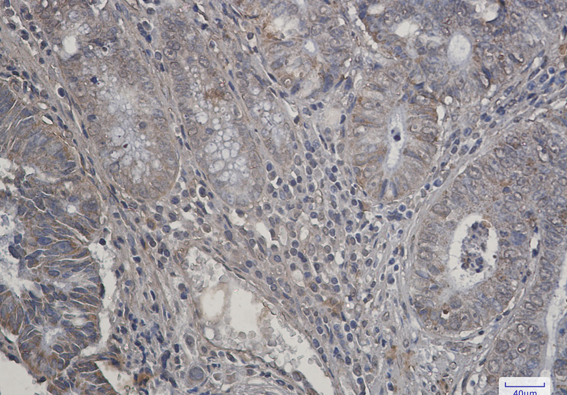 4 - [KO]P70 S6 Kinase beta/SRK Rabbit mAb AP75858