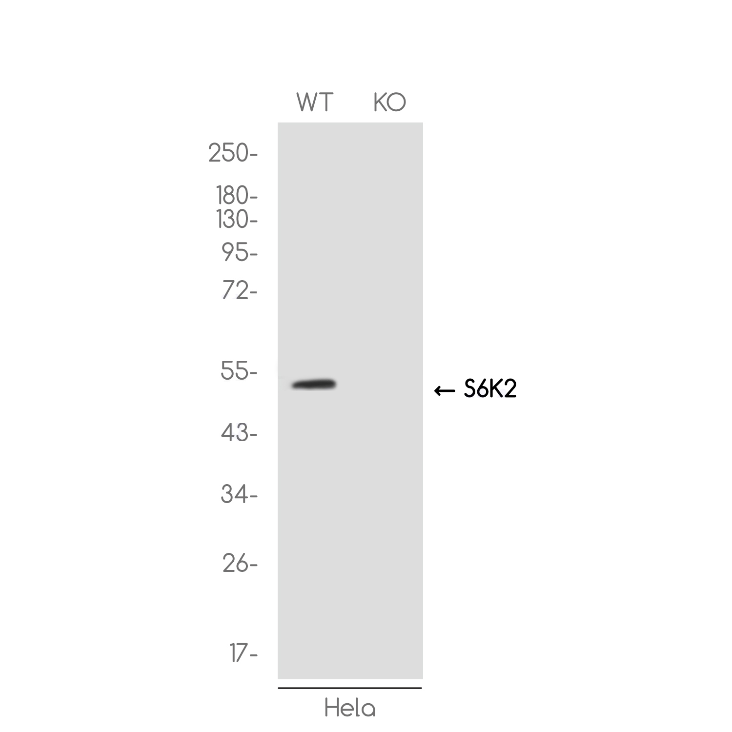1 - [KO]P70 S6 Kinase beta/SRK Rabbit mAb AP75858