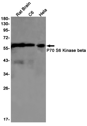 8 - [KO]P70 S6 Kinase beta/SRK Rabbit mAb AP75858