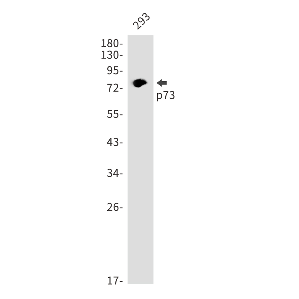 1 - p73 Rabbit mAb AP75859