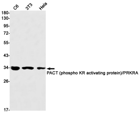 1 - PRKRA Rabbit mAb AP75862
