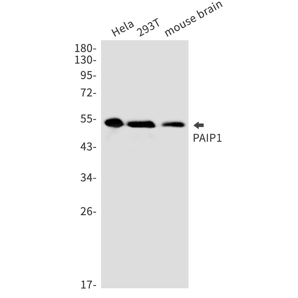 1 - [KD]PAIP1 Rabbit mAb AP75865