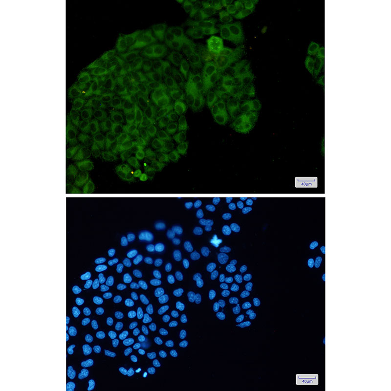 2 - Phospho-PAK1/2/3 (Ser144/Ser141/Ser154) Rabbit mAb AP75866