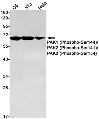 1 - Phospho-PAK1/2/3 (Ser144/Ser141/Ser154) Rabbit mAb AP75866