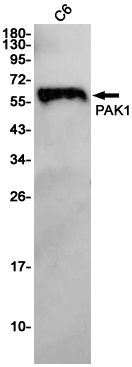 3 - PAK1 Rabbit mAb AP75867
