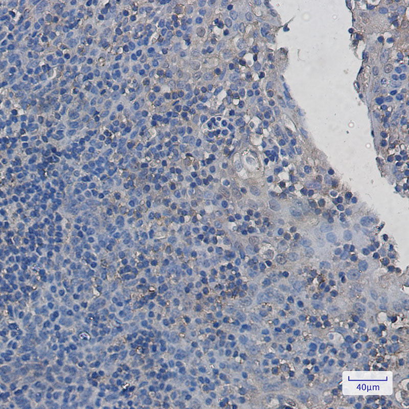 2 - PAK2 Rabbit mAb AP75868