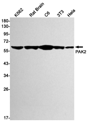 1 - PAK2 Rabbit mAb AP75868
