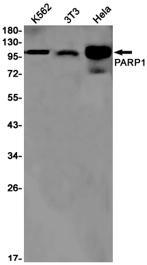 1 - PARP1 Rabbit mAb AP75870