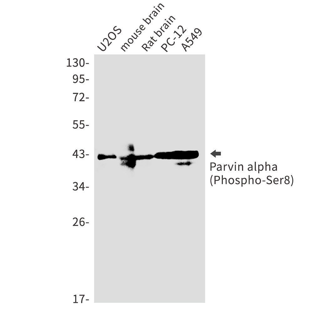 1 - Phospho-Parvin alpha (Ser8) Rabbit mAb AP75871