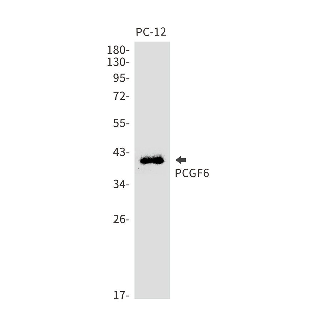 1 - PCGF6 Rabbit mAb AP75875