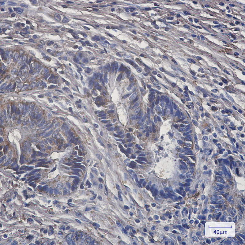 8 - PCK2 Rabbit mAb AP75876