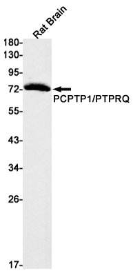 1 - PCPTP1 Rabbit mAb AP75877