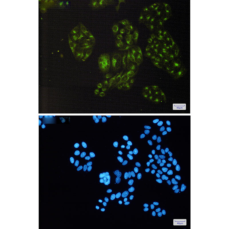 8 - PDLIM1/CLP36 Rabbit mAb AP75885