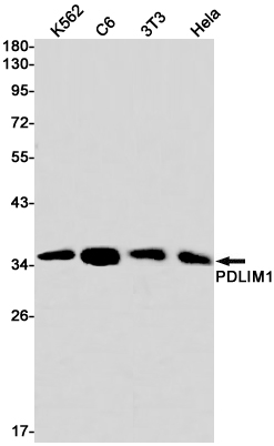 1 - PDLIM1/CLP36 Rabbit mAb AP75885