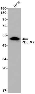 1 - [KD]PDLIM7 Rabbit mAb AP75886