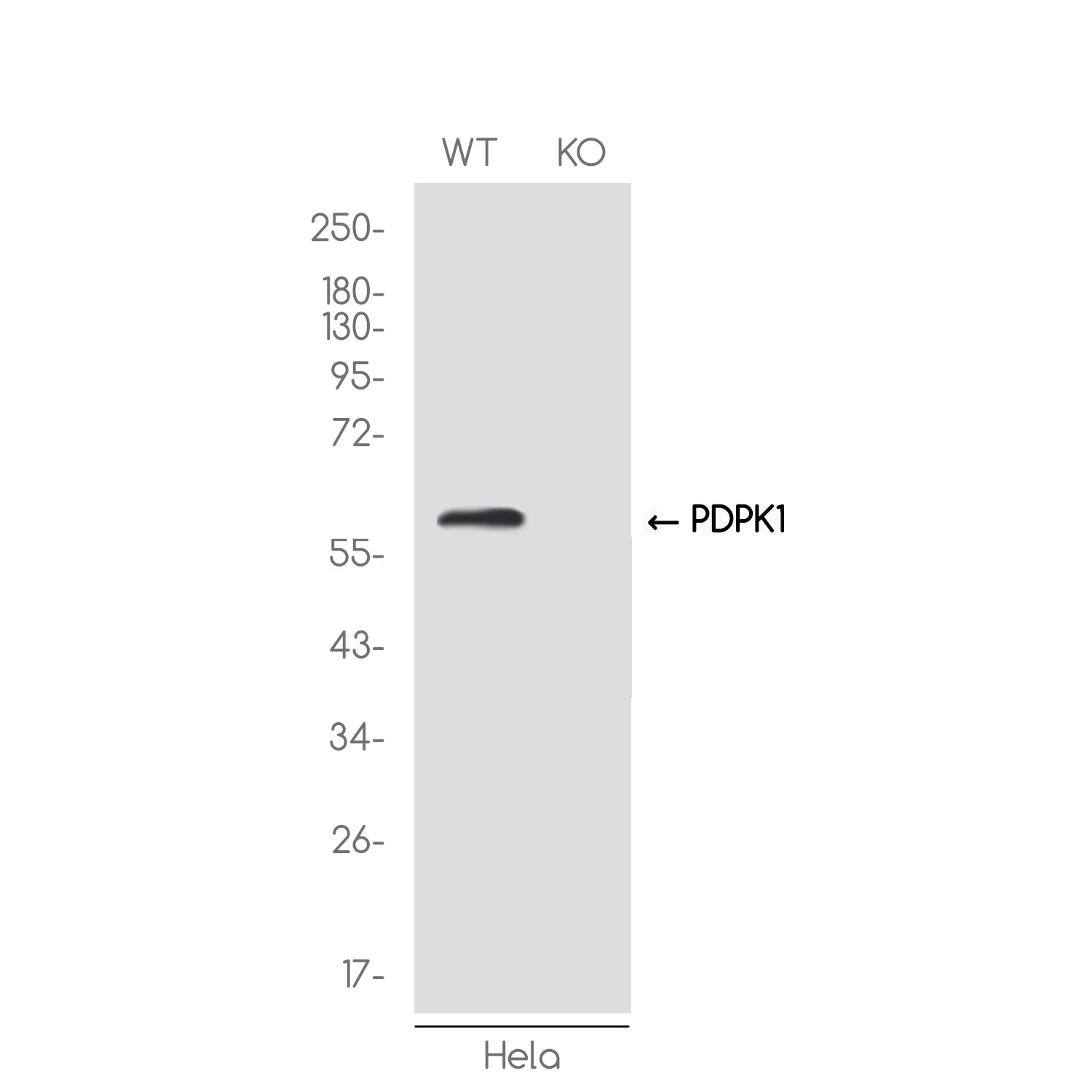 1 - [KO]PDPK1 Rabbit mAb AP75887