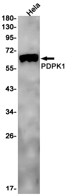 2 - [KO]PDPK1 Rabbit mAb AP75887