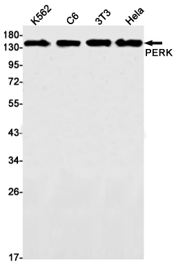1 - PERK Rabbit mAb AP75893