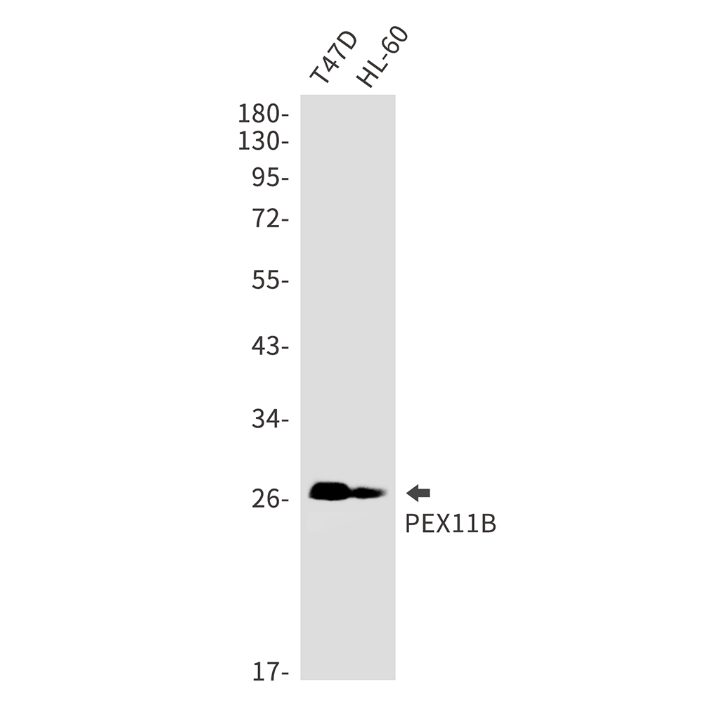1 - PEX11B Rabbit mAb AP75897