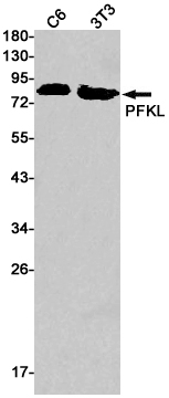1 - PFKL Rabbit mAb AP75898