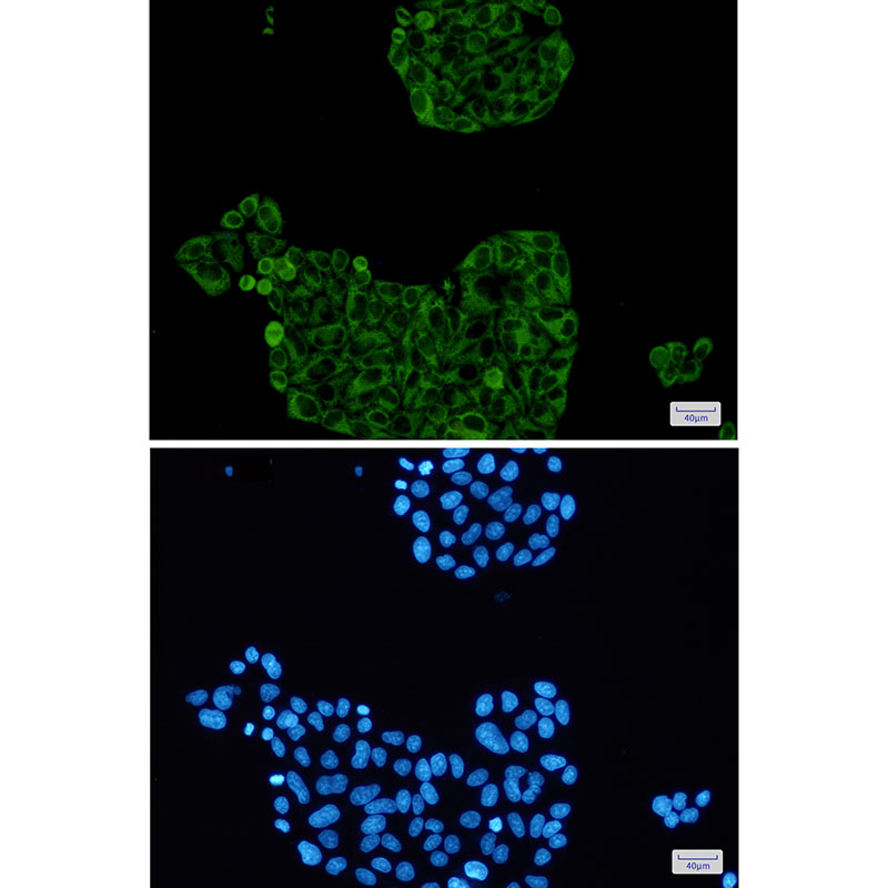8 - PFKP Rabbit mAb AP75899