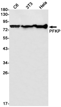 1 - PFKP Rabbit mAb AP75899