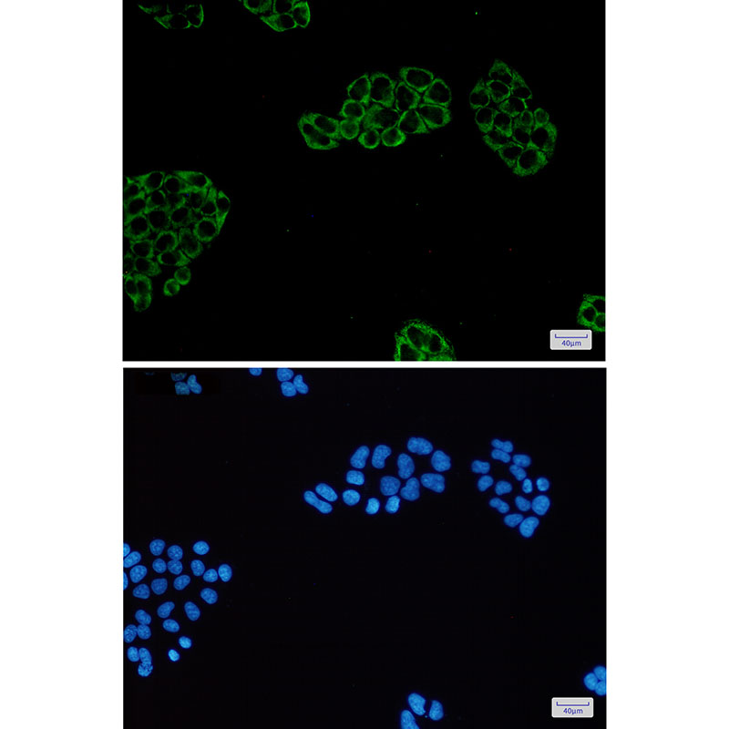 8 - PGM1 Rabbit mAb AP75901