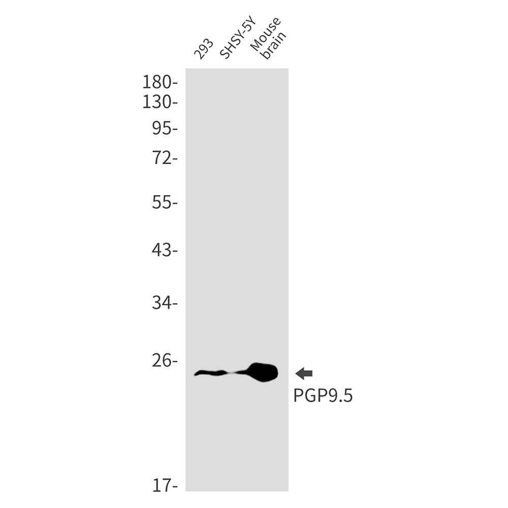 1 - UCH-L1/PGP9.5 Rabbit mAb AP75902