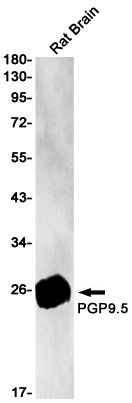 2 - UCH-L1/PGP9.5 Rabbit mAb AP75902