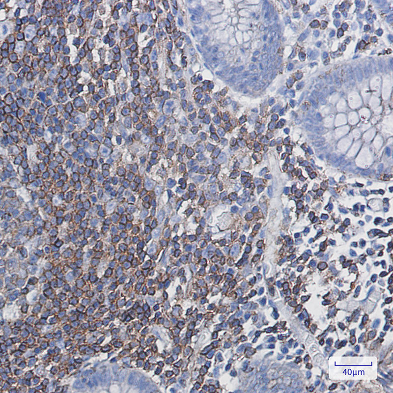 5 - PHD3 Rabbit mAb AP75904