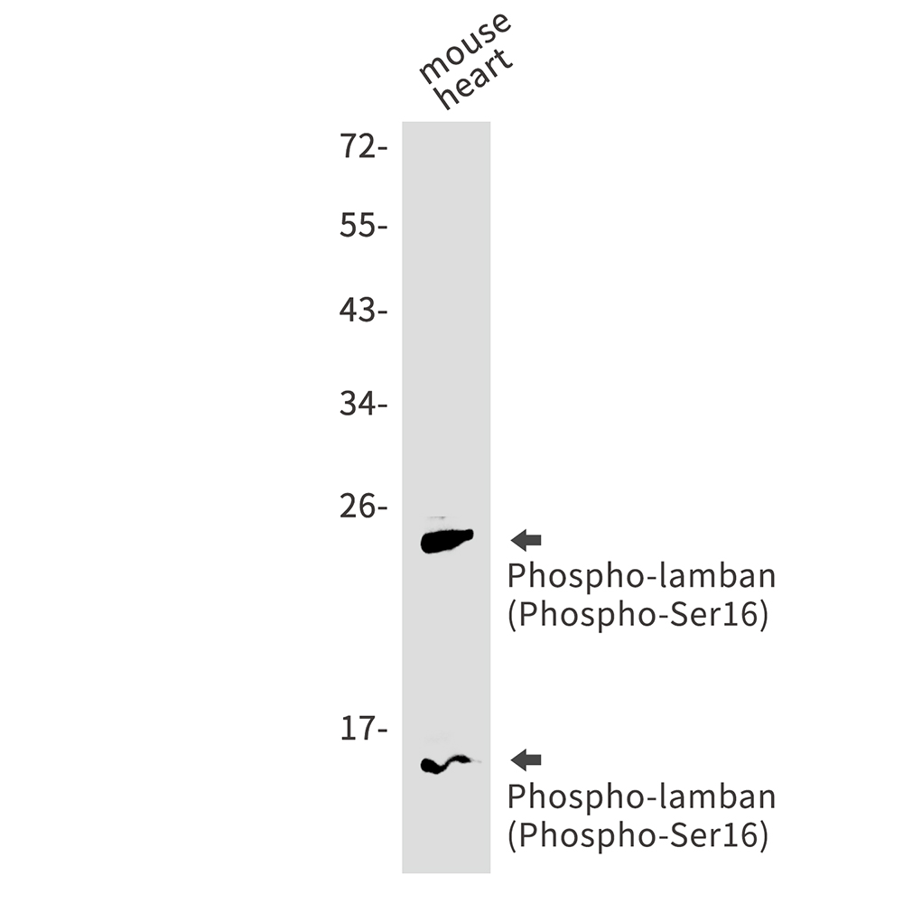 1 - Phospho-Phospholamban (Ser16) Rabbit mAb AP75906